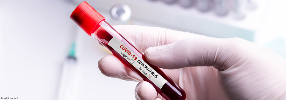 Coronavirus : la Haute autorité de santé met en garde contre l’usage des autotests