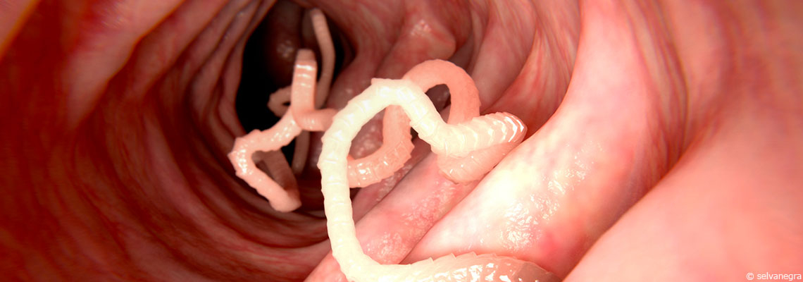 Parasites : des troubles pas toujours faciles à diagnostiquer